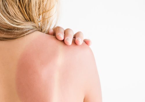 womans back skin hurt from sun burn-img-blog