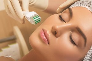 Women can undergo a microneedling procedure to increase the collagen and elastin production in her face.