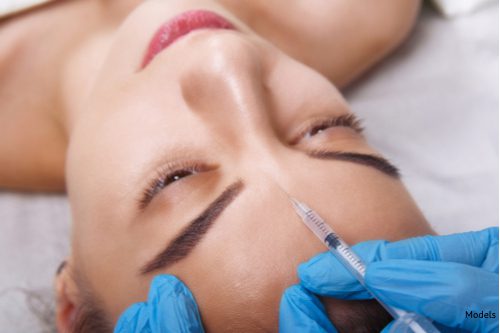 A woman received an injectable filler to soften the wrinkle prone areas and improve her facial scars