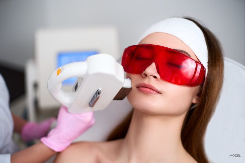 Woman undergoing an elos laser treatmetn at her medispa. Protected by red eye goggles.