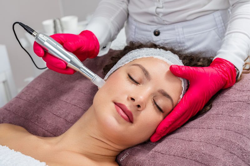 Woman undergoing microneedling treatment with microneedling pen.