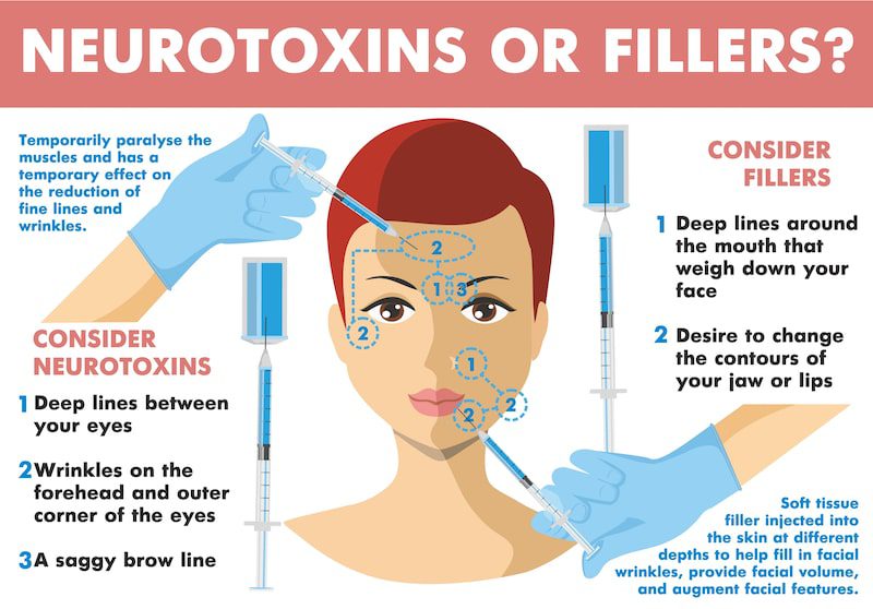 Infographic demonstrating the differences between dermal fillers and neurotoxins