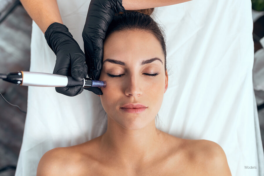 Image of esthetician or medical provider applying a micro needling device onto a woman.