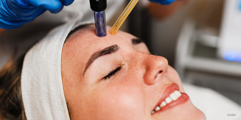 Young woman getting a microneedling procedure done