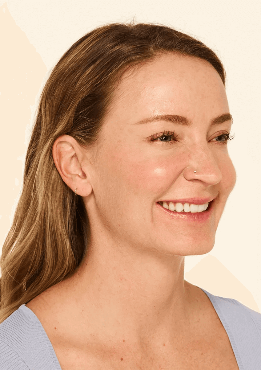 Actual Patient After 3