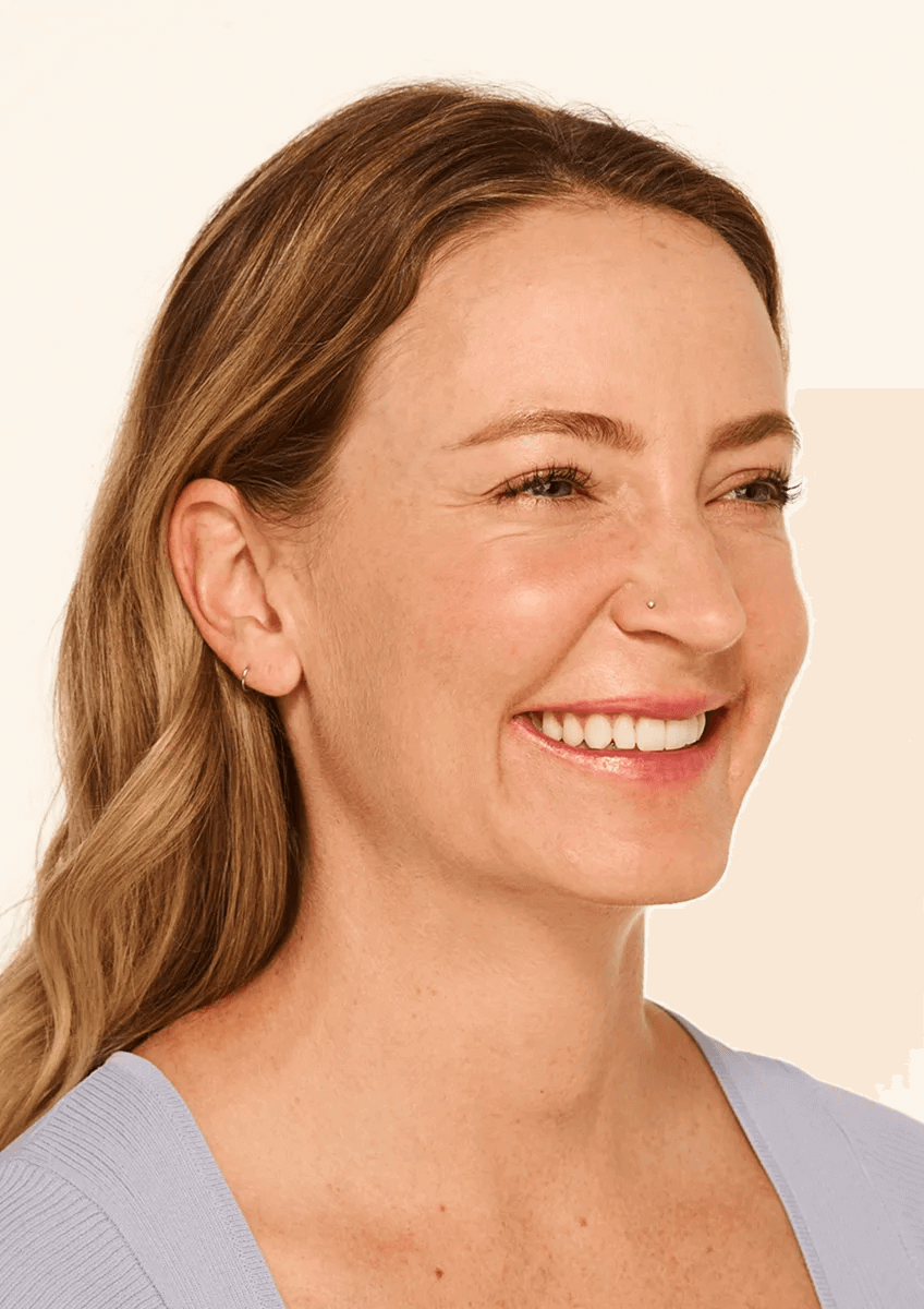 Actual Patient Before 3