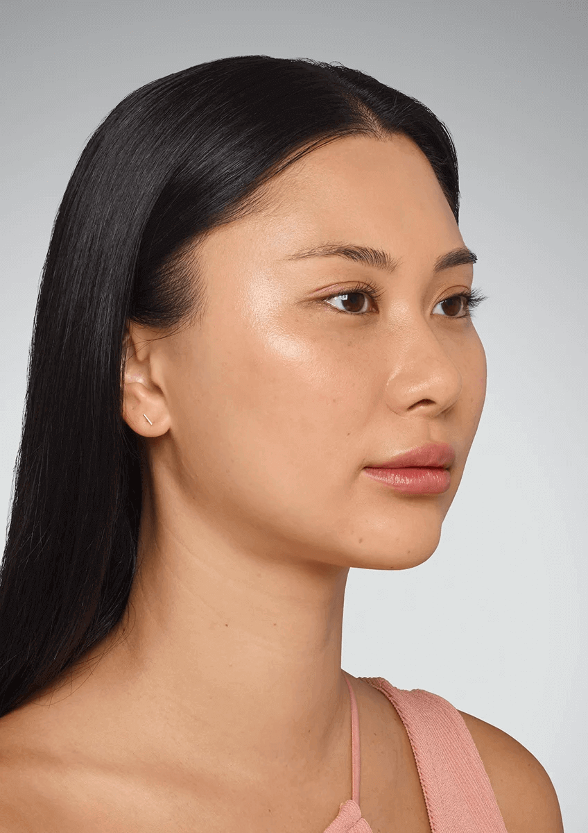 Actual Patient After 2