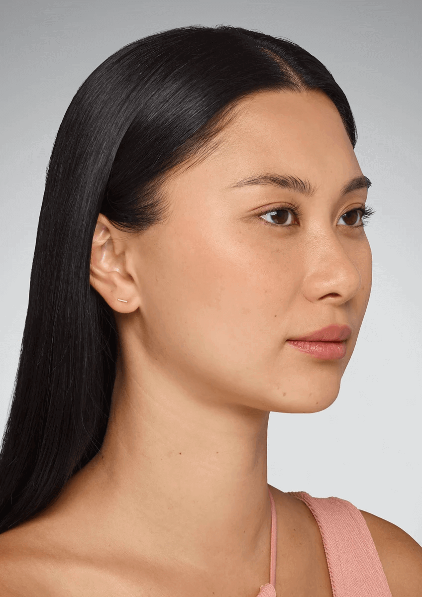 Actual Patient Before 2